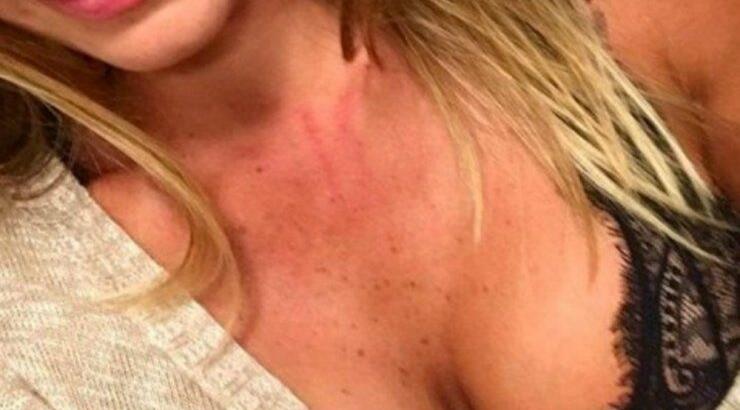 Πασίγνωστο μοντέλο σοκάρει: “O πρώην σύντροφός μου με κακοποιούσε”