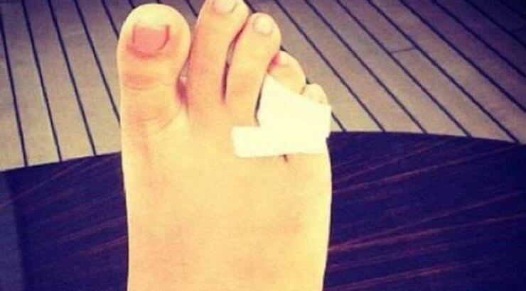 Ποιά διάσημη έσπασε το δάχτυλό της;