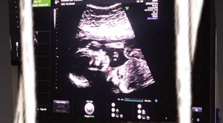 Κύπρια ηθοποιός μας αποκάλυψε την εγκυμοσύνη της δείχνοντάς μας το υπερηχογράφημα [εικόνα]
