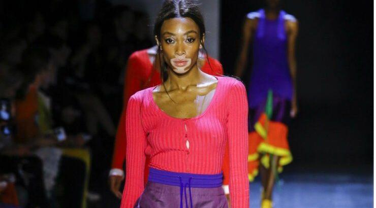 Συνδύασε basic κομμάτια σε έντονα χρώματα για ένα φρέσκο καλοκαιρινό look