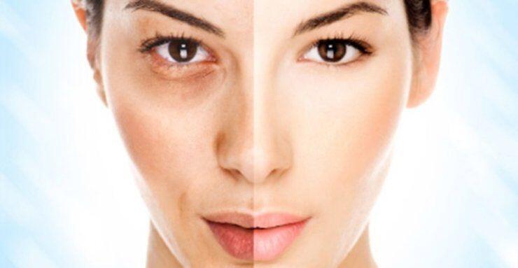 5 μύθοι και αλήθειες που οφείλετε να γνωρίζετε για την αντιγήρανση 