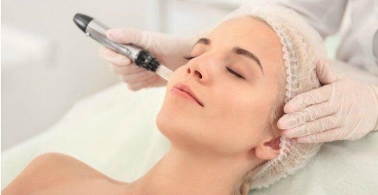 Θεραπεία Micro – needling: Αυτό το διαγωνισμό ομορφιάς μην τον χάσετε