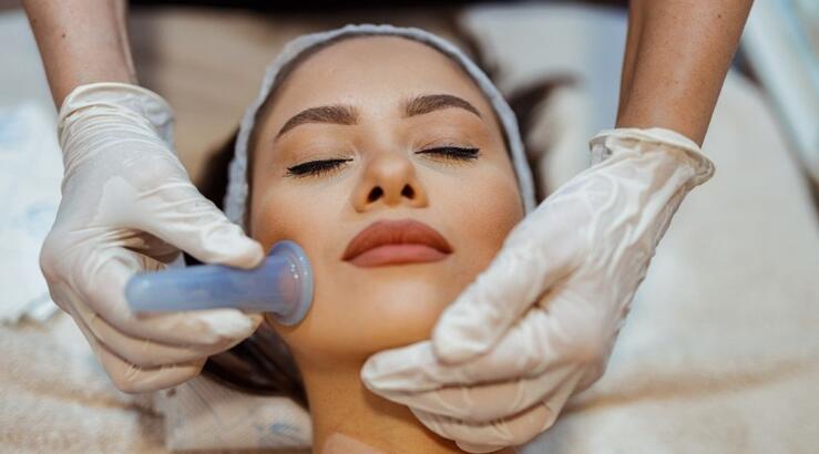 Facial cupping: Όλα όσα πρέπει να γνωρίζεις για το μασάζ προσώπου με βεντούζες