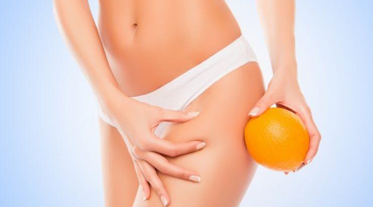 Κυτταρίτιδα: 3+1 επαγγελματικές θεραπείες για να την καταπολεμήσεις