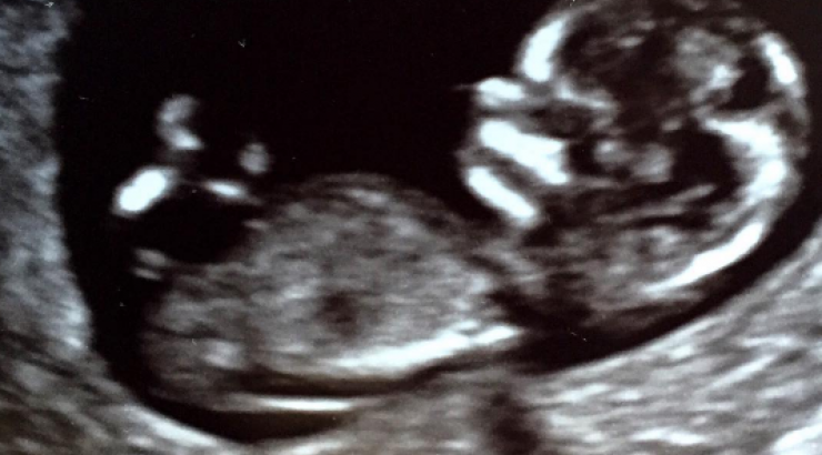 Ηθοποιός είναι έγκυος για πρώτη φορά!