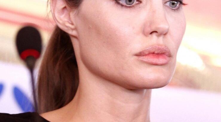 Σοκάρουν οι δηλώσεις της χειρουργού της Angelina Jolie