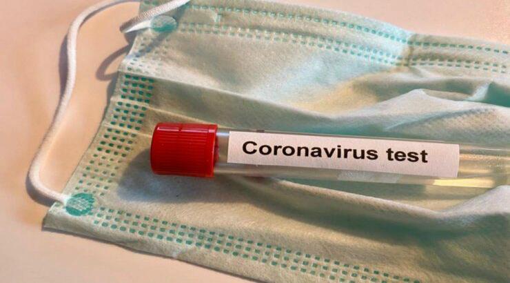 O 14χρονoς γιος Κύπριου τραγουδιστή αποκάλυψε ότι έχει συμπτώματα κορωνοϊού [βίντεο]