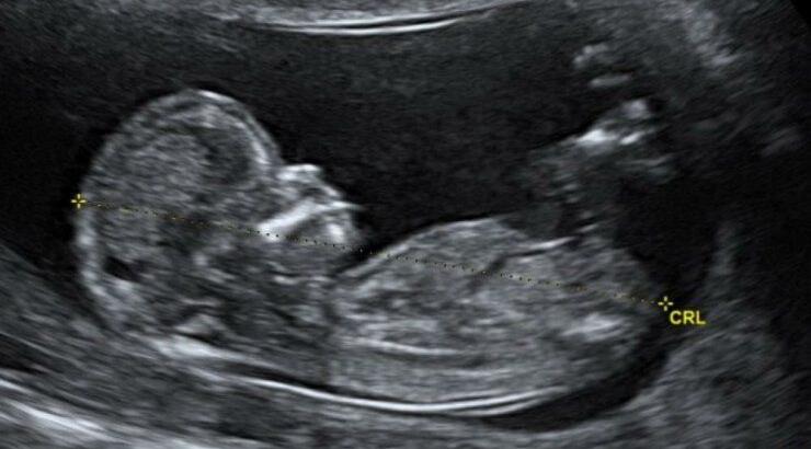 Ζευγάρι της showbiz περιμένει το πρώτο του μωράκι και μας έδειξαν το υπερηχογράφημα! 