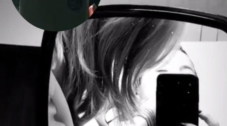 Επώνυμη Κύπρια φούσκωσε τα χείλη της και μας έδειξε τη διαδικασία στο instagram!