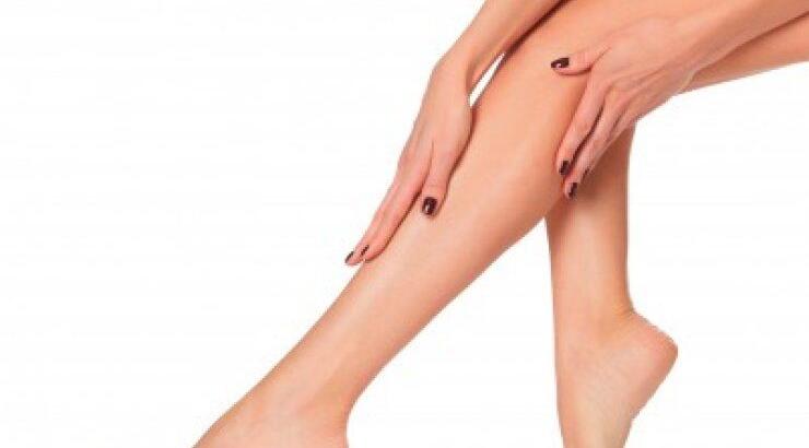 Πώς να αντιμετωπίσεις τους κιρσούς