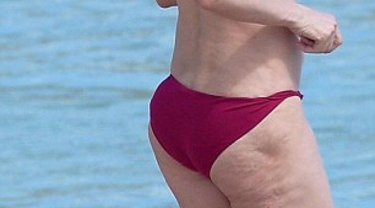 Ποια πασίγνωστη ηθοποιός βγήκε στην παραλία, μας έδειξε την σιλουέτα της και έπεσαν όλοι να την "φάνε" λόγω κυτταρίτιδας;