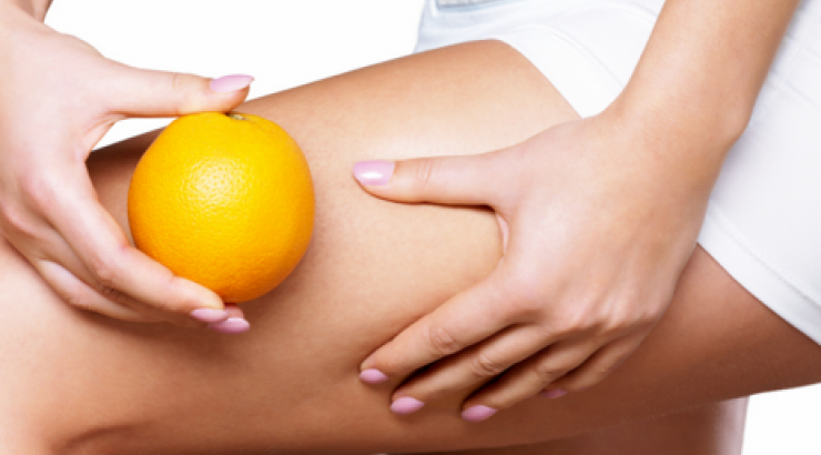 Γιατί οι γυναίκες έχουν κυτταρίτιδα;