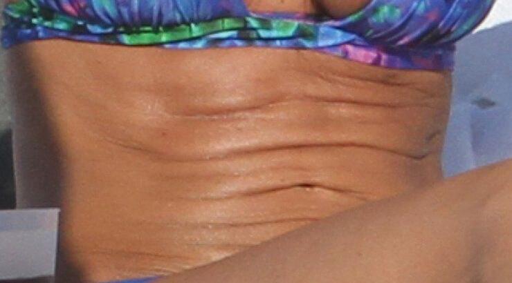 Ποια διάσημη έχει αυτή τη ‘’ζαρωμένη’’ κοιλιά; [εικόνες]