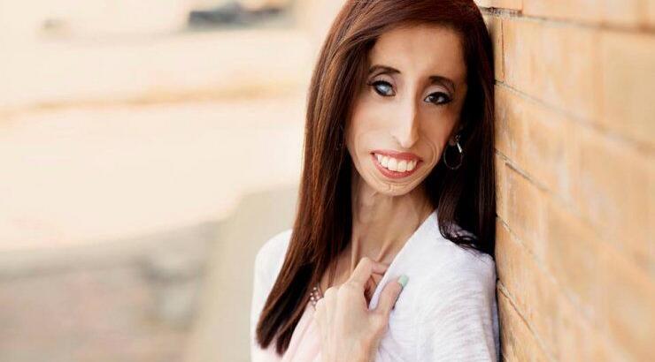 Η εκπληκτική ομιλία της πιο άσχημης γυναίκας στον κόσμο