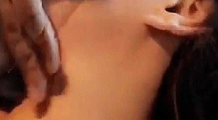 Πασίγνωστη ηθοποιός έκανε lifting και ανέβασε φωτογραφίες από την επέμβαση στα social media