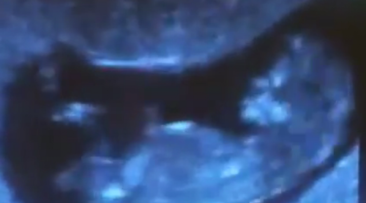 Ξανά γονείς πασίγνωστο ζευγάρι της ελληνικής showbiz!