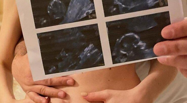 Έλληνας παρουσιαστής περιμένει το πρώτο του μωράκι! [εικόνες]