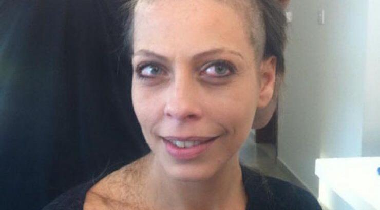 Η Μαρία Μιχαήλ με ξυρισμένο κεφάλι