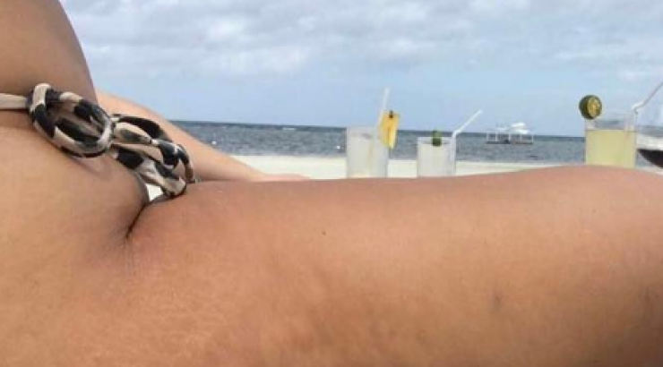 Η φωτογραφία επώνυμης Κύπριας στο instagram με την κυτταρίτιδα!