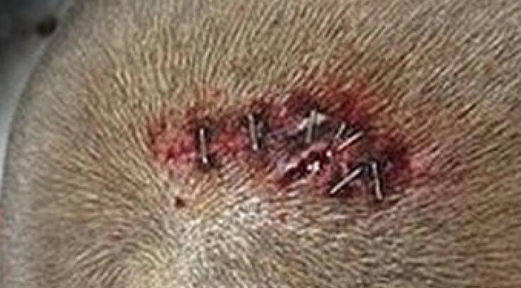 Γνωστός ποδοσφαιριστής σόκαρε τους πάντες όταν ανέβασε στο instagram τα ράμματα που έκανε στο κεφάλι του!