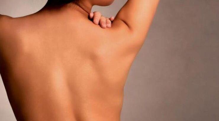  Σπυράκια στην πλάτη: Απαλλαγείτε σε 5 βήματα 