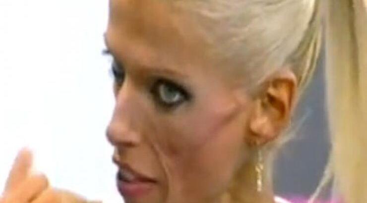 Νανά Καραγιάννη: «Έπρεπε να είχα ζητήσει πιο νωρίς ιατρική βοήθεια»