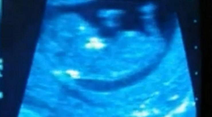 Επώνυμη Ελληνίδα περιμένει το πρώτο της μωράκι!