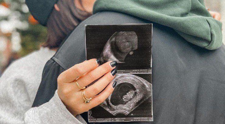 Γνωστό fashion girl του νησιού περιμένει το πρώτο της παιδί [εικόνες]