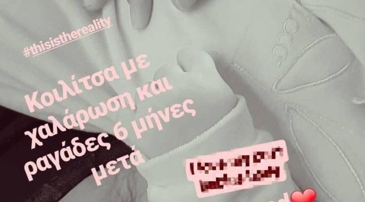 Επώνυμη της κυπριακής showbiz μας δείχνει την χαλάρωση και τις ραγάδες στην κοιλιά μετά την εγκυμοσύνη