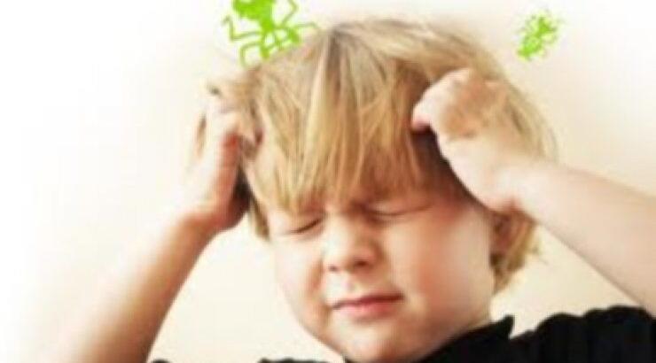 Όλα όσα πρέπει να γνωρίζετε για τις ψείρες στο κεφάλι του μωρού σας 