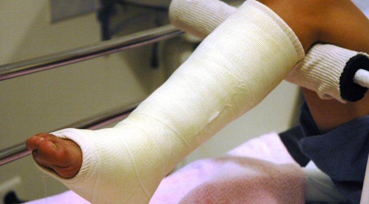 Γυναίκα με σπασμένο πόδι πέθανε περιμένοντας ορθοπεδικό