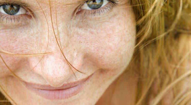 Όλα όσα θέλετε να μάθετε για την προφιλοπλαστική!  