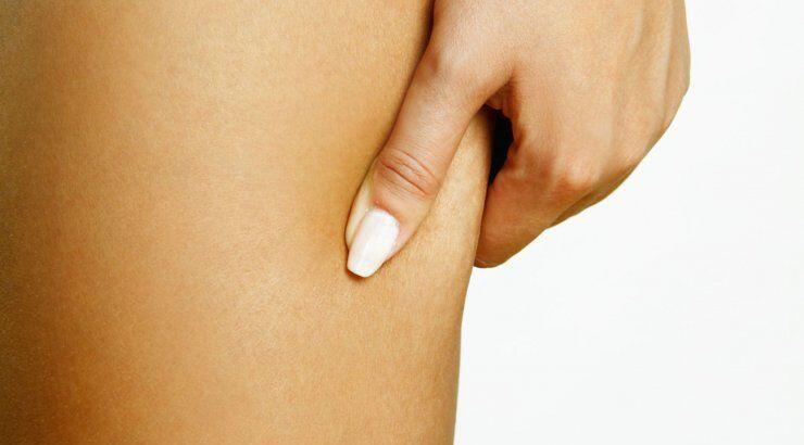 5 τρόποι για να απαλλαγείς από τις ραγάδες