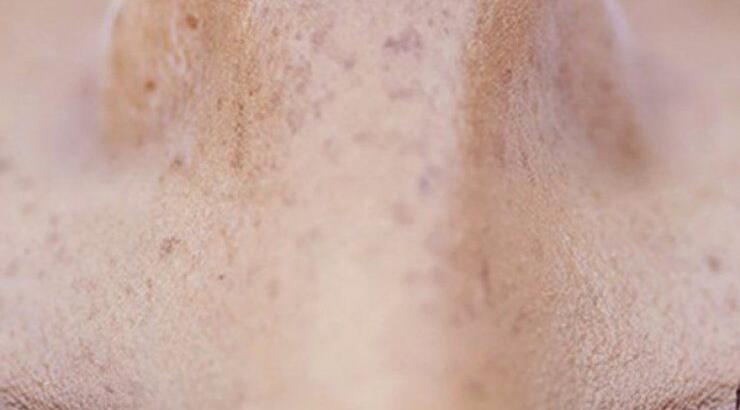 4 λόγοι που η ρετινόλη είναι η καλύτερη λύση ομορφιάς