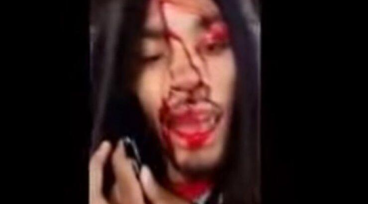 Απίστευτο! Πυροβόλησαν τραγουδιστή στο κεφάλι και εκείνος έβγαλε selfie βίντεο