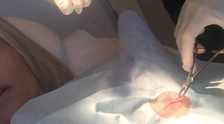 Η συγκλονιστική εξομολόγηση γνωστής ηθοποιού για τον καρκίνο!