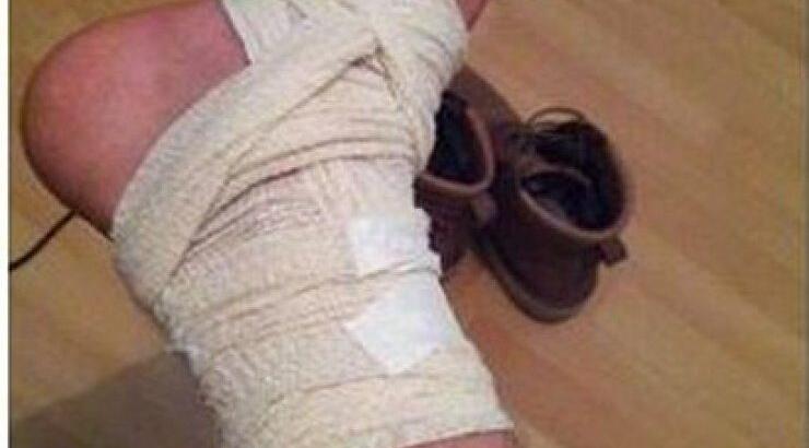 Ποιος Κύπριος ηθοποιός έσπασε το πόδι του πριν την πρεμιέρα της παράστασης του;