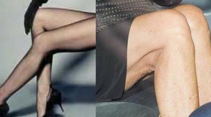 Έφτασε στα 81 αλλά τα φημισμένα πόδια της "κρατούν" ακόμη με μικρές απώλειες...