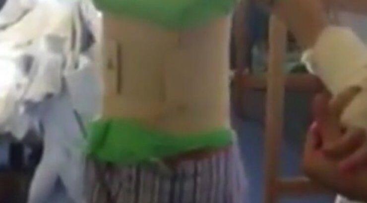 Το ατύχημα για επώνυμη Κύπρια που σημάδεψε τη ζωή της!