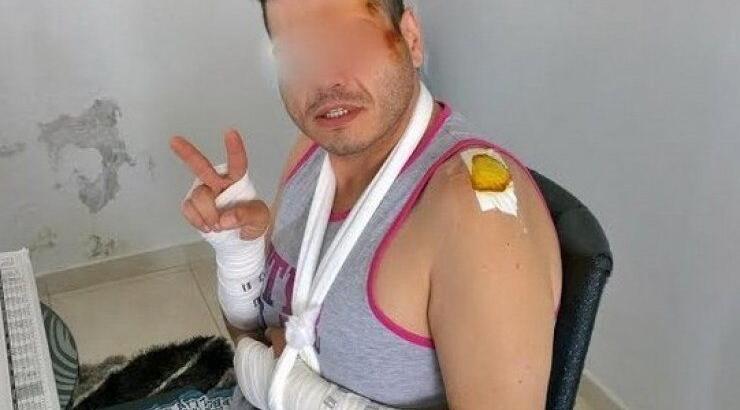 Έλληνας τραγουδιστής χτύπησε άσχημα στο κεφάλι [εικόνα]