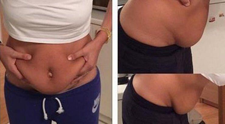 Η πασίγνωστη μανούλα της ελληνικής showbiz δημοσίευσε την κοιλιά της δύο μήνες μετά την γέννα της