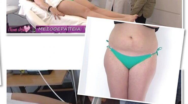 Μεσοθεραπεία: Μια νέα επαναστατική θεραπεία! [βίντεο]