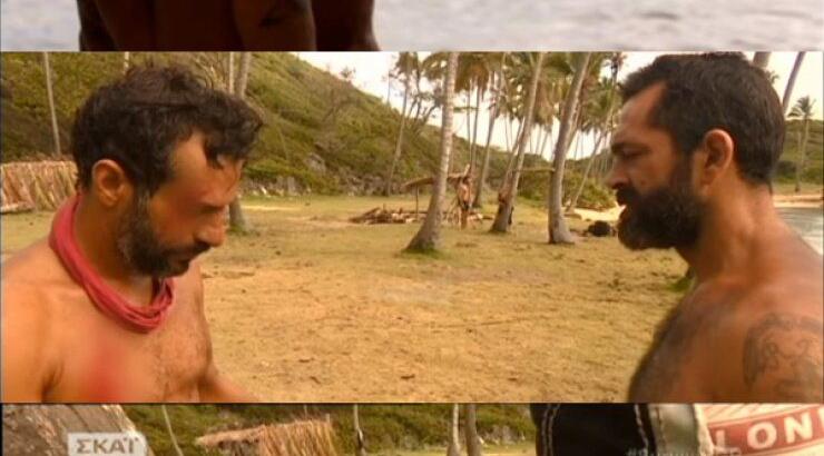 Σοβαρό ατύχημα στην παραλία για τον Γιώργο Χρανιώτη - Γέμισε αίματα το πρόσωπό και το στήθος του!