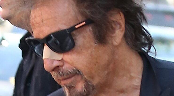 Το ατύχημα που είχε πασίγνωστος σταρ του Hollywood [εικόνες]