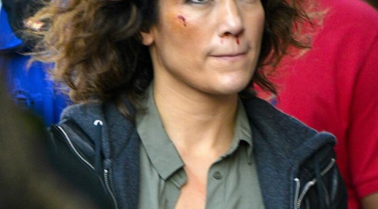 Jennifer Lopez: Με εκδορές και αίματα στο πρόσωπο [εικόνες]