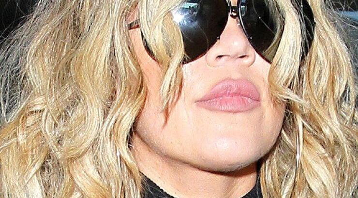 Khloe Kardashian: Οι πλαστικές επεμβάσεις δεν έχουν τελειωμό [εικόνες]