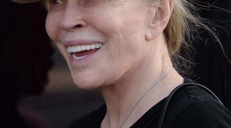 Δείτε πως έγινε 74χρονη πασίγνωστη σταρ του Hollywood έπειτα από απανωτές πλαστικές [εικόνες]