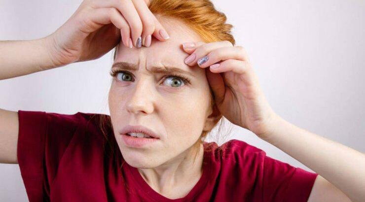 DIY μάσκα που εξαφανίζει την ακμή 