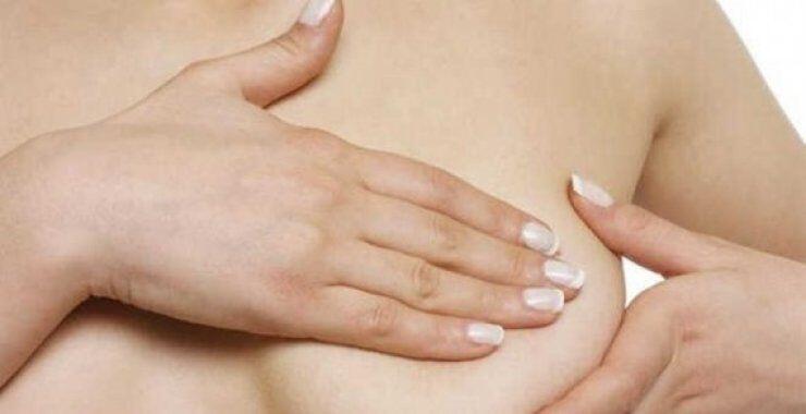 Προληπτική μαστεκτομή: όλα όσα πρέπει να γνωρίζετε