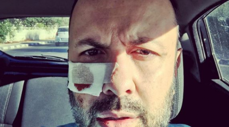 Μάθαμε τι συνέβη στον Τάσο Τρύφωνος!